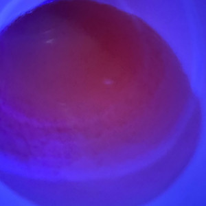 Drugie by NCLclipz