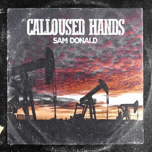 Calloused Hands by Sam Donald