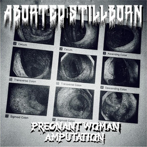 Aborted Stillborn - Possession