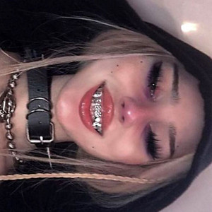thermogenic l-carnitine I got my lip filler dissolved main image 1