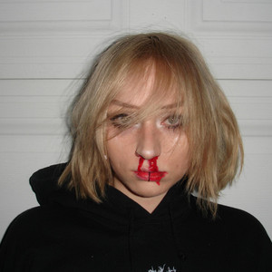 nosebleed