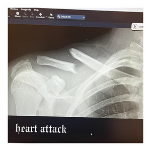 heart attack demo by loser_theorem