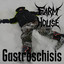 Gastroschisis