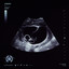 Track cover