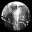 Cyclic Melancholia