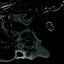 Irreversible Cessation