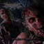Avascular Necrosis cover