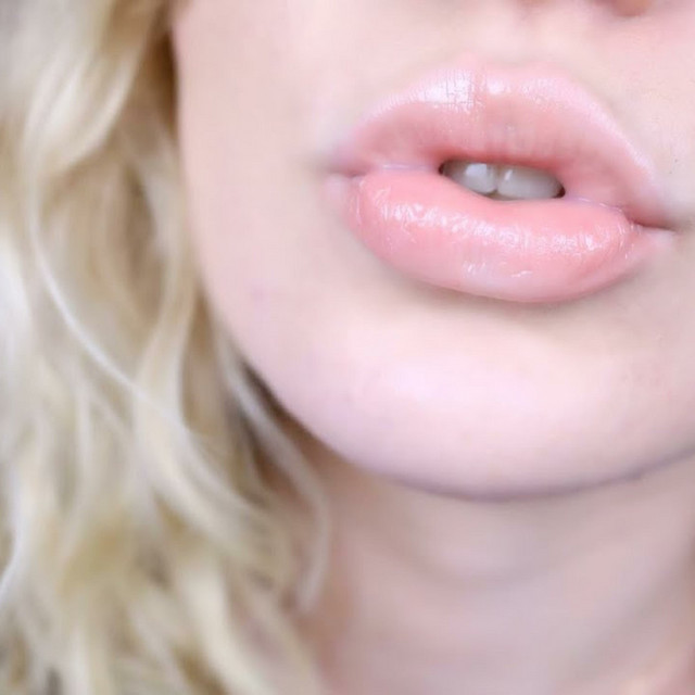 Up close kisses all over cover art