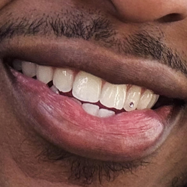No Veneers cover art