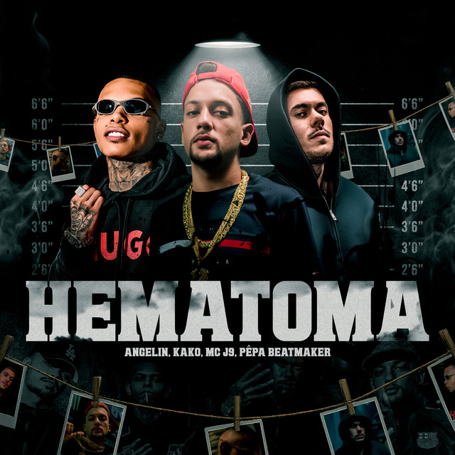 Hematoma