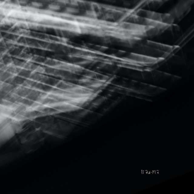 Fracture cover art
