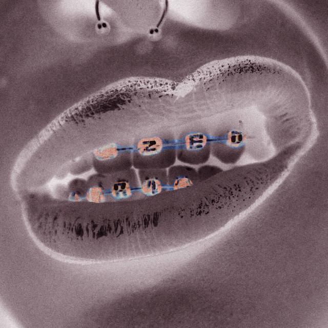 A1 cover art