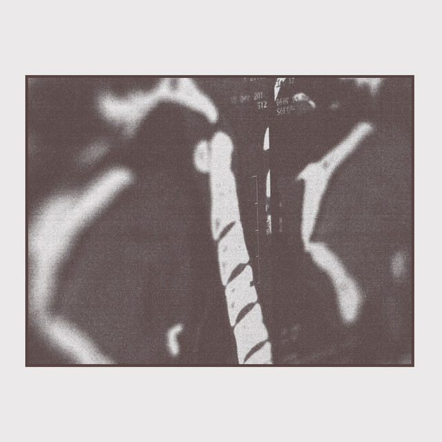 MRI cover art
