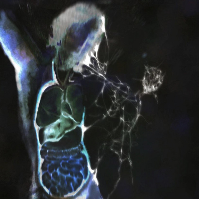 INFINITO NERO cover art