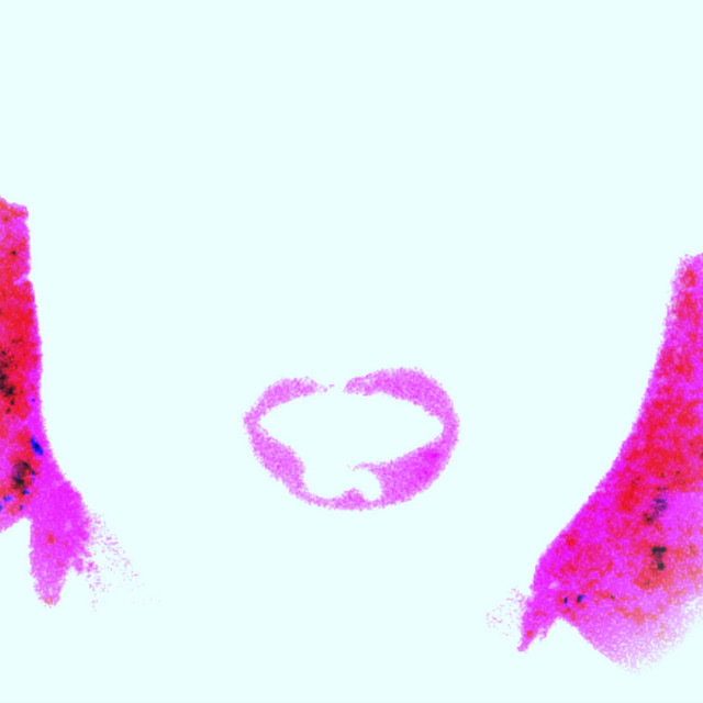 NOHOPE cover art