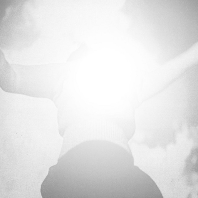 After the Dream You Are Awake (Deluxe Edition) cover art