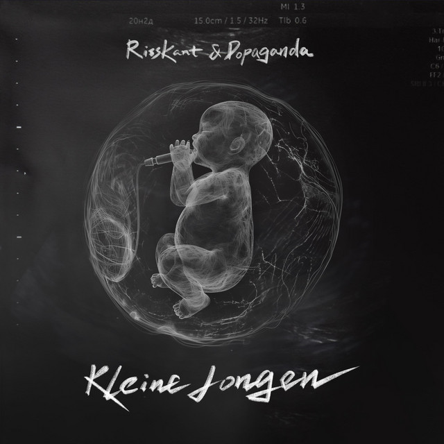 Kleine Jongen