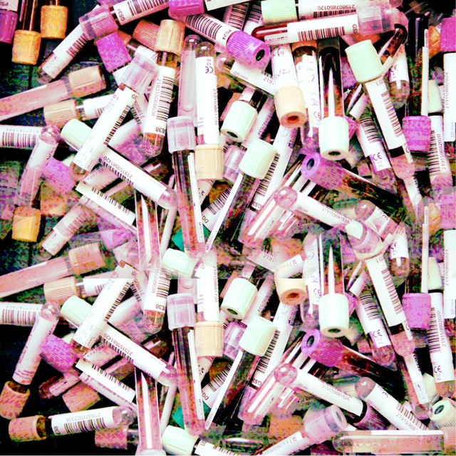 Methane Gas album image