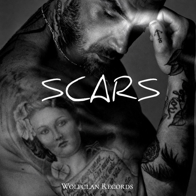 scars (acustico) cover