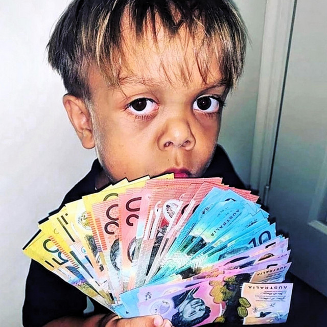 Down Syndrome cover art