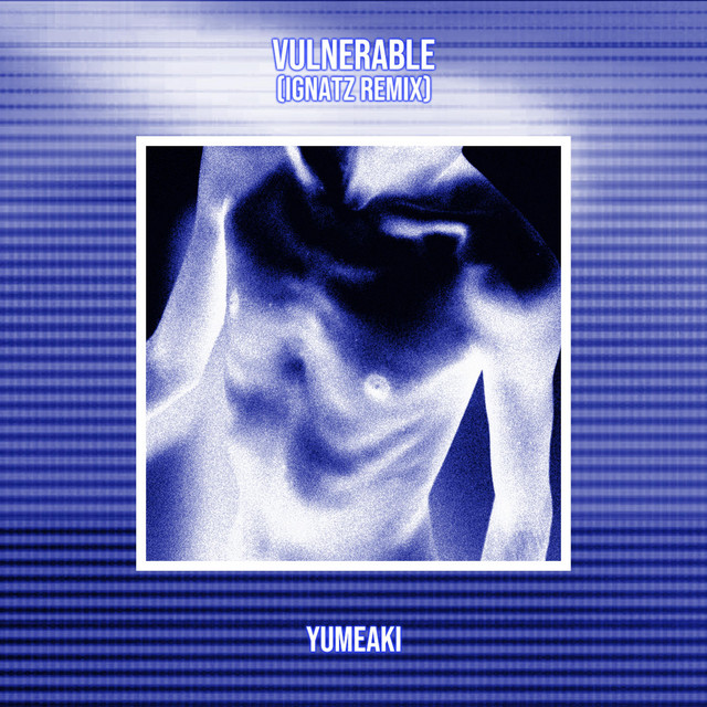 Vulnerable (Ignatz Remix) cover art
