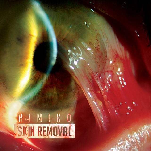 Skin Removal cover art