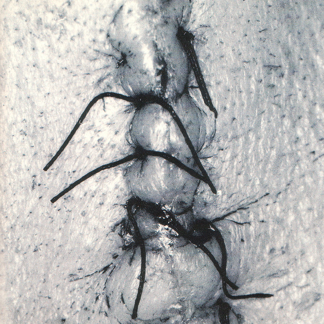 Infliction cover art