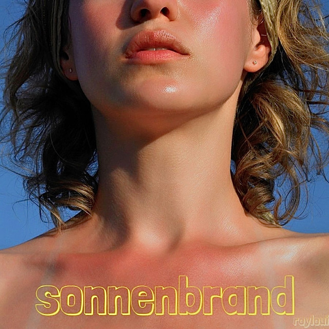 Sonnenbrand