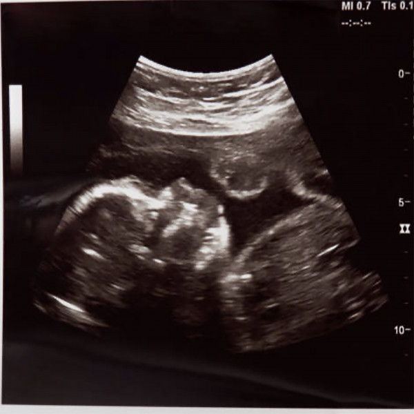 Womb Sounds cover art