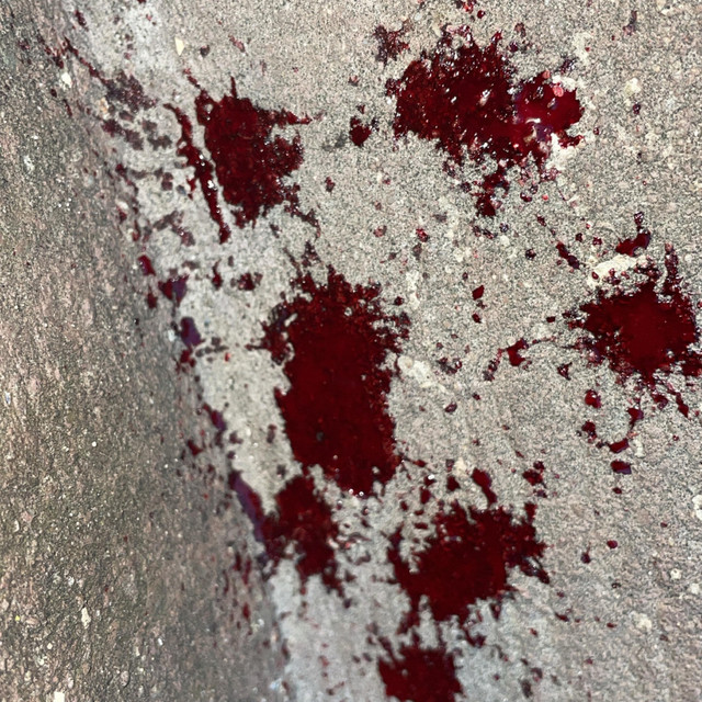 My Blood Is Beautiful cover art
