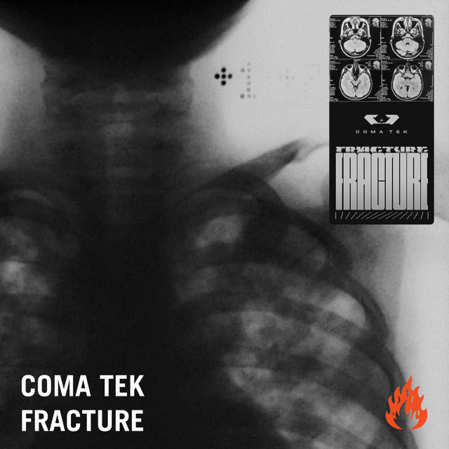 Fracture album art