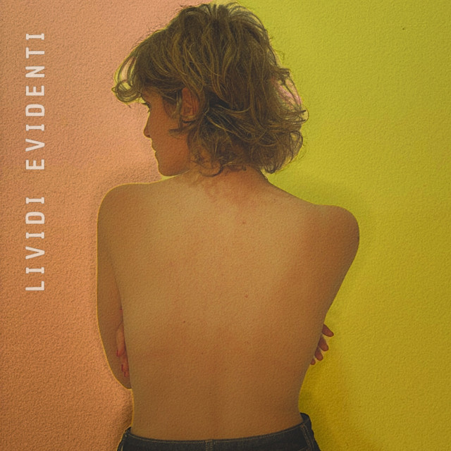 Lividi evidenti