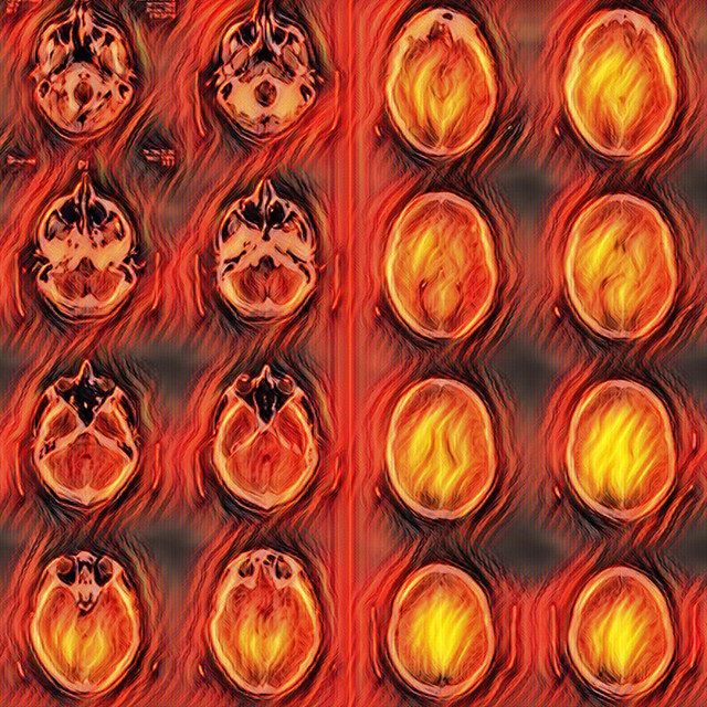 Isolation cover art
