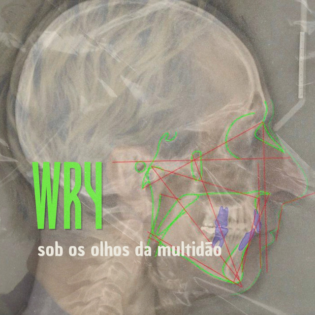 Sob os Olhos da Multidão cover