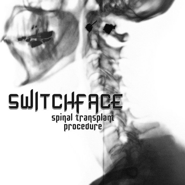Spinal Transplant Procedure cover