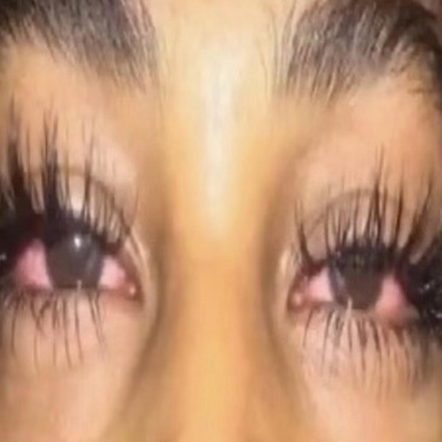 Pradabae