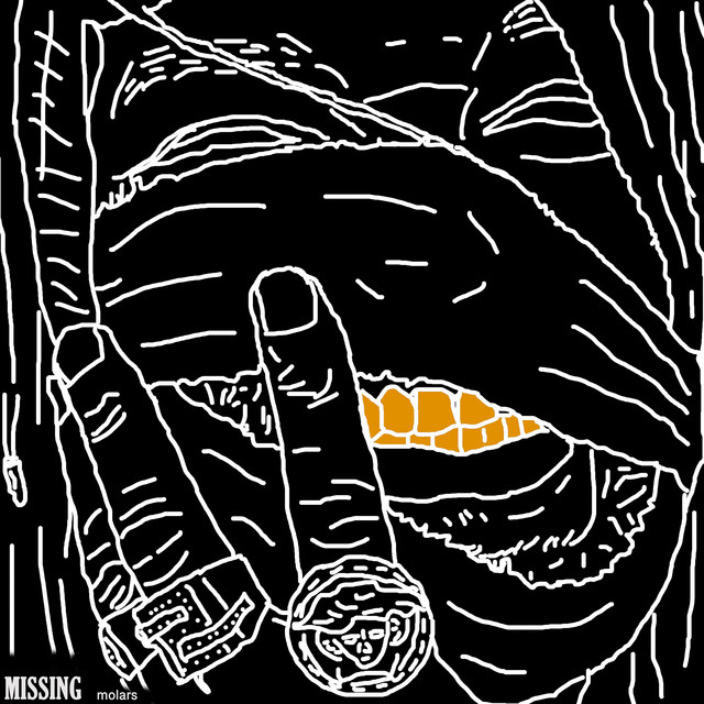Missing Molars (SWNT Deluxe) cover art