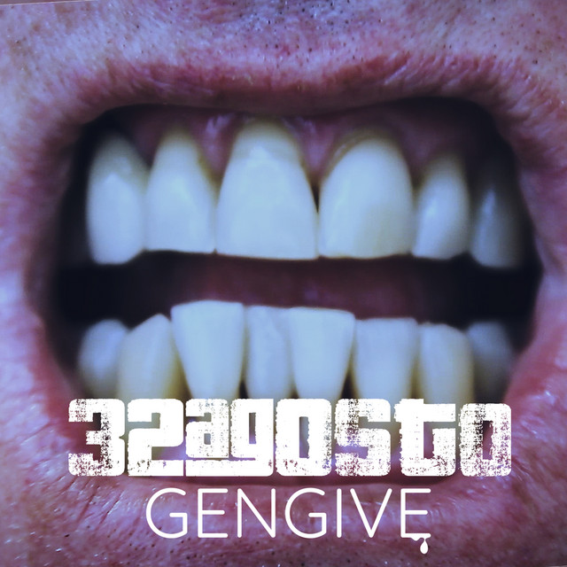 Gengive