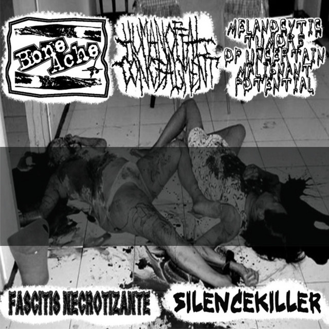 Tracks Off 5way W/ Human Offal Concealment / Melanocytic Tumors Of Uncertain Malignant Potential / Silencekiller / Fascitis Necrotizante cover art