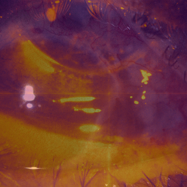 Bloop cover art