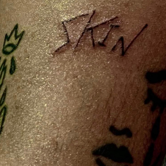SKIN