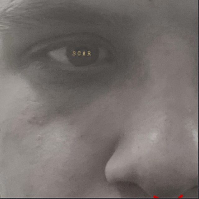 Scar cover art