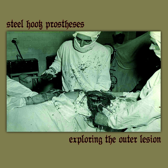 Steel Hook Prostheses photo