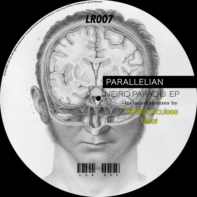 Parallelian