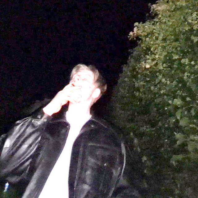 A I D S