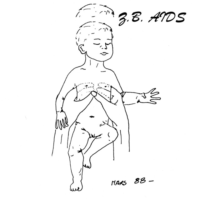 Z.B. Aids