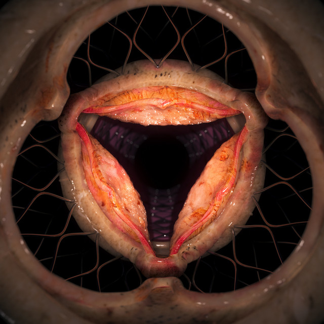 Aperture cover art