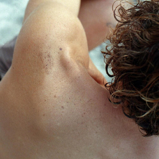 Freckles cover art