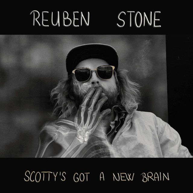 Scotty's Got A New Brain cover