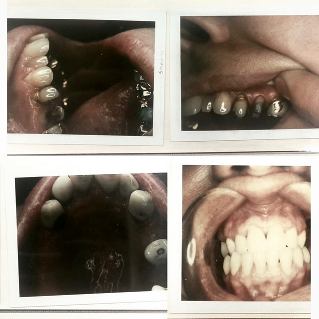 Taking Teeth: Volume 2 cover art